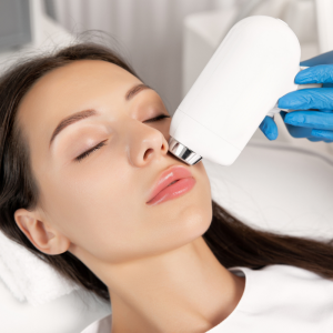 IPL Treatment