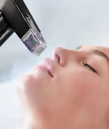 Danielle Lloyd's Morpheus8 treatment - this picture is an example of the treatment and does not show Danielle Lloyd