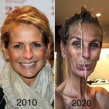 ulrika jonsson skin sun damage alcohol fiji skin clinic before and after
