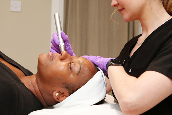Dermapen Microneedling