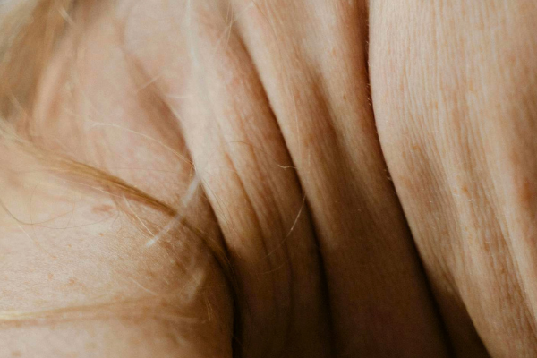 Fine Lines & Wrinkles